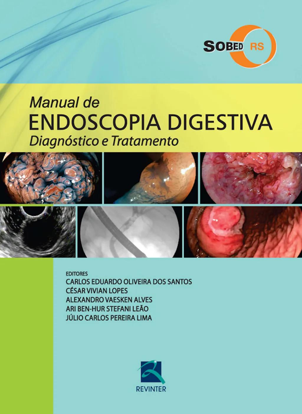 Manual de endoscopia digestiva - SOBED/RS
